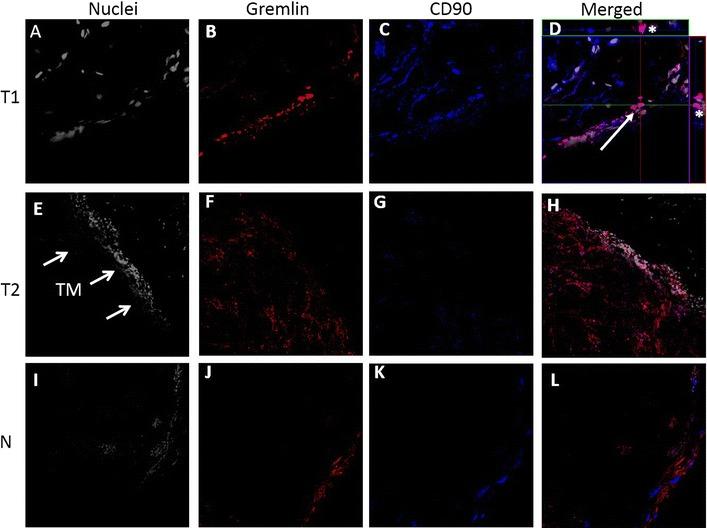 https://cdn.ncbi.nlm.nih.gov/pmc/blobs/d808/5146849/c60a6a25caa9/12967_2016_1091_Fig2_HTML.jpg
