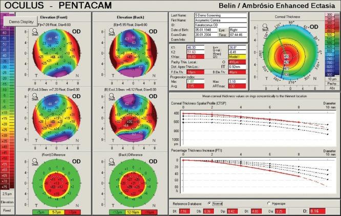 https://cdn.ncbi.nlm.nih.gov/pmc/blobs/d80d/3775073/d71033a7cfea/IJO-61-401-g007.jpg