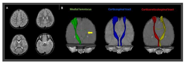 https://cdn.ncbi.nlm.nih.gov/pmc/blobs/d80d/7911173/1c99dcbc1992/children-08-00081-g001.jpg