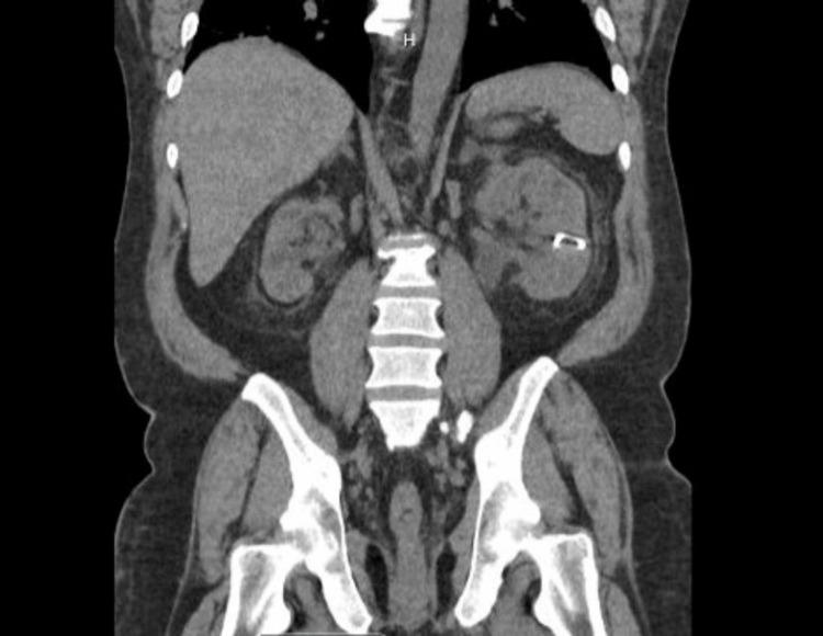 https://cdn.ncbi.nlm.nih.gov/pmc/blobs/d80e/10979708/34c2894670f6/cureus-0016-00000055130-i05.jpg