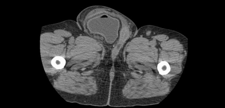 https://cdn.ncbi.nlm.nih.gov/pmc/blobs/d80e/10979708/369d18e7d349/cureus-0016-00000055130-i04.jpg