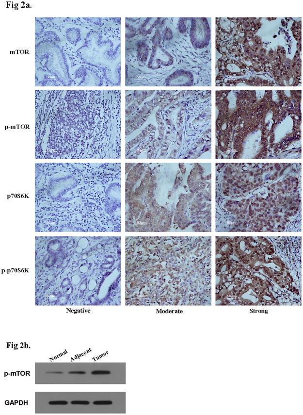 https://cdn.ncbi.nlm.nih.gov/pmc/blobs/d80e/5179011/d26608147aa9/pone.0168085.g002.jpg
