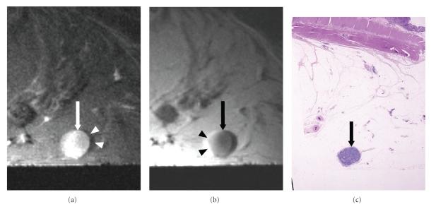 https://cdn.ncbi.nlm.nih.gov/pmc/blobs/d810/2817863/04062e212bd8/IJBI2009-659836.008.jpg