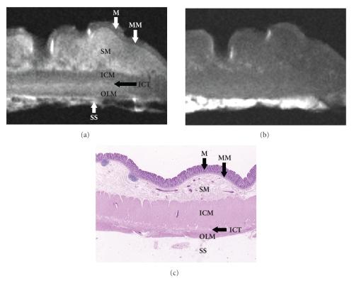 https://cdn.ncbi.nlm.nih.gov/pmc/blobs/d810/2817863/0e7b13827d09/IJBI2009-659836.001.jpg
