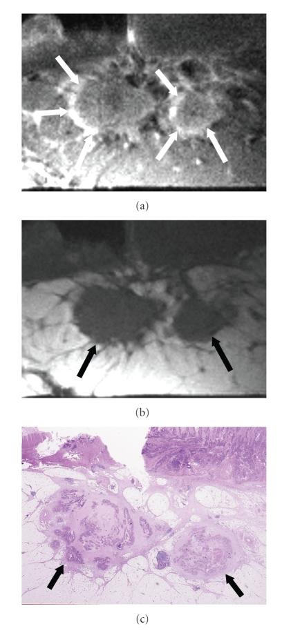 https://cdn.ncbi.nlm.nih.gov/pmc/blobs/d810/2817863/5b60301464d9/IJBI2009-659836.006.jpg