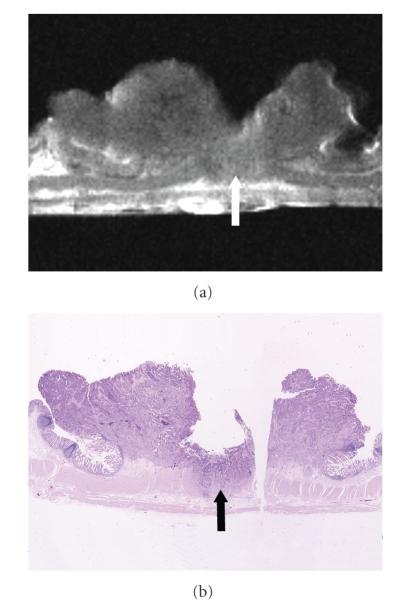https://cdn.ncbi.nlm.nih.gov/pmc/blobs/d810/2817863/7605a8ea1a99/IJBI2009-659836.004.jpg