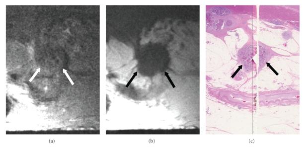 https://cdn.ncbi.nlm.nih.gov/pmc/blobs/d810/2817863/9ea7d9570901/IJBI2009-659836.007.jpg