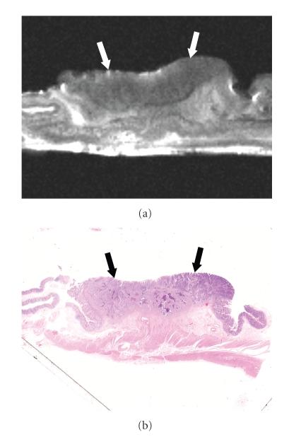 https://cdn.ncbi.nlm.nih.gov/pmc/blobs/d810/2817863/bf44ffa6430e/IJBI2009-659836.003.jpg