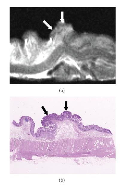 https://cdn.ncbi.nlm.nih.gov/pmc/blobs/d810/2817863/ddd4ab1a6316/IJBI2009-659836.002.jpg