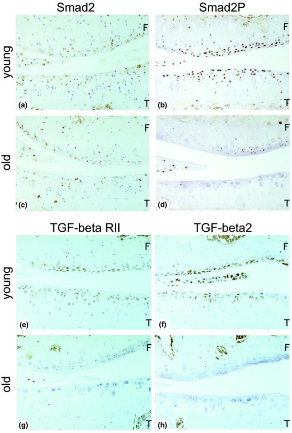 https://cdn.ncbi.nlm.nih.gov/pmc/blobs/d814/1297583/76c5a99583d9/ar1833-2.jpg