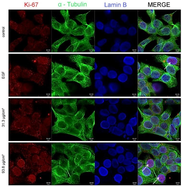 https://cdn.ncbi.nlm.nih.gov/pmc/blobs/d819/5295208/f345e54b1d59/nanomaterials-07-00018-g005.jpg