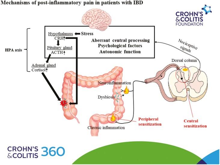https://cdn.ncbi.nlm.nih.gov/pmc/blobs/d81b/9802269/822aff8f82ec/otab073_iffig1.jpg
