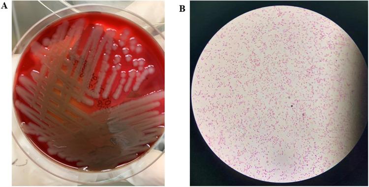 https://cdn.ncbi.nlm.nih.gov/pmc/blobs/d823/10454767/212f35643d8b/IDR-16-5453-g0001.jpg