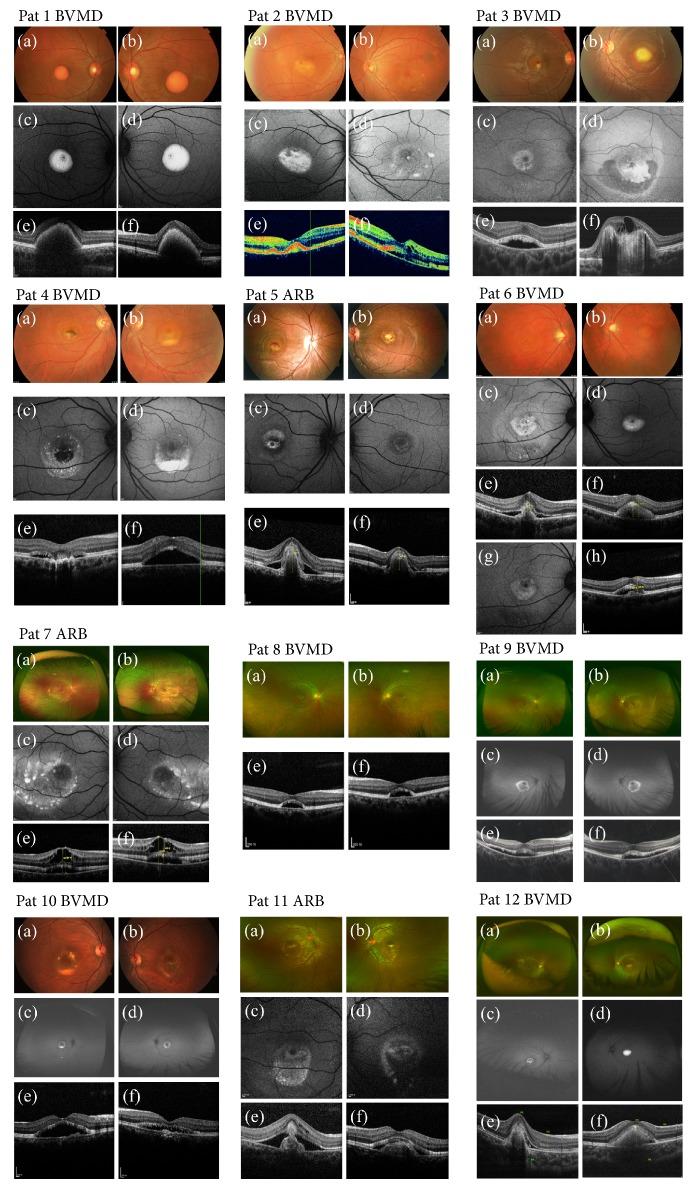 https://cdn.ncbi.nlm.nih.gov/pmc/blobs/d823/6220750/3412a20fecfa/BMRI2018-4582816.002.jpg
