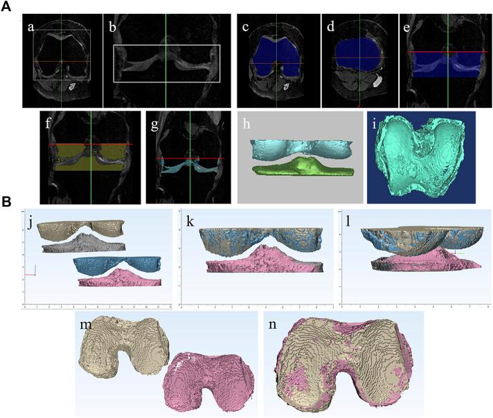 https://cdn.ncbi.nlm.nih.gov/pmc/blobs/d825/9892457/e45e6998286d/fcell-11-1106279-g001.jpg
