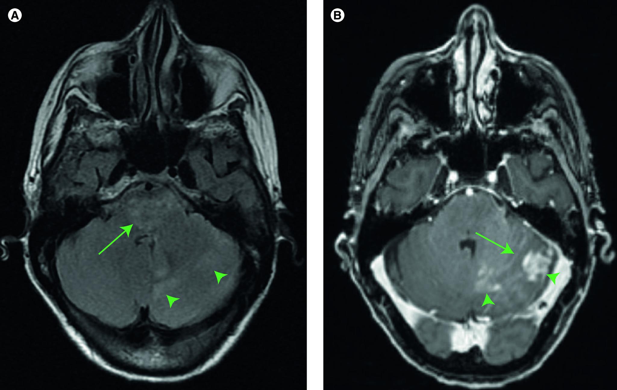 https://cdn.ncbi.nlm.nih.gov/pmc/blobs/d828/8162147/b9f9028ffa9a/cns-10-71-g1.jpg