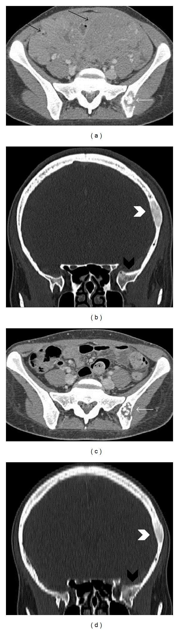 https://cdn.ncbi.nlm.nih.gov/pmc/blobs/d829/3625573/7448d76ee3da/CRIM.RADIOLOGY2013-940160.003.jpg