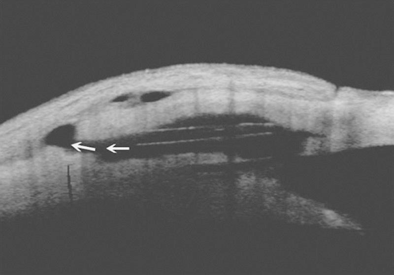https://cdn.ncbi.nlm.nih.gov/pmc/blobs/d829/4521906/a09868992b0e/ijg-24-421-g006.jpg