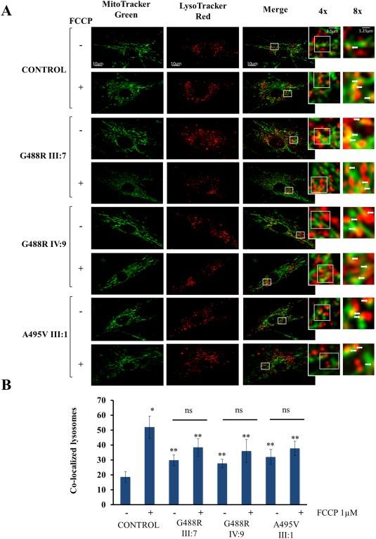 https://cdn.ncbi.nlm.nih.gov/pmc/blobs/d829/5008165/3e3126099400/ANA-78-21-g010.jpg