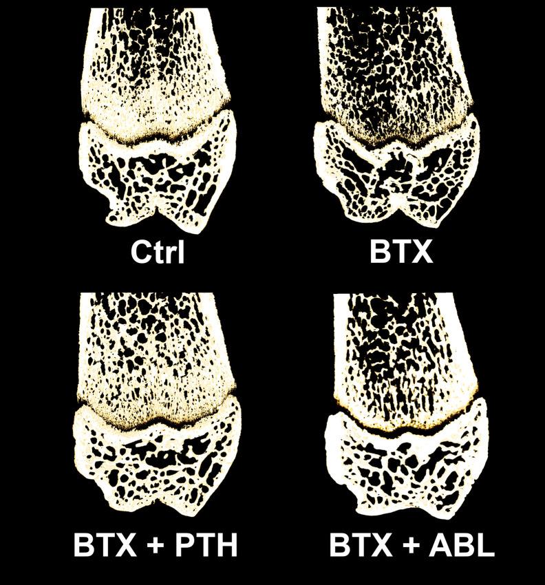 https://cdn.ncbi.nlm.nih.gov/pmc/blobs/d829/7581786/53b93df8705c/fendo-11-588773-g006.jpg