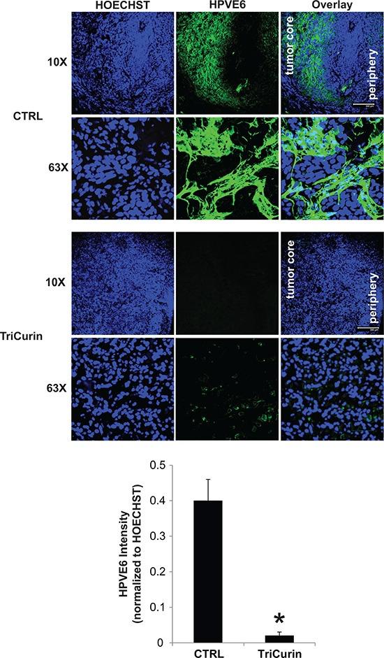 https://cdn.ncbi.nlm.nih.gov/pmc/blobs/d82e/5601119/8640ebc64383/oncotarget-08-60025-g004.jpg