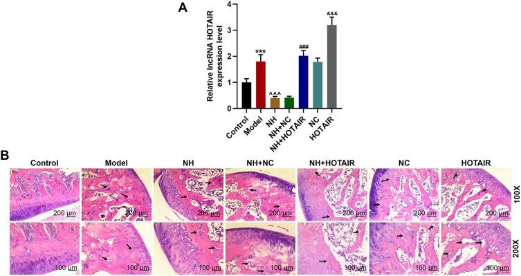 https://cdn.ncbi.nlm.nih.gov/pmc/blobs/d82e/7733036/954e18ac8f24/DDDT-14-5419-g0001.jpg