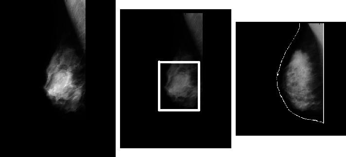 https://cdn.ncbi.nlm.nih.gov/pmc/blobs/d83b/9998154/eb2e08d1a7c2/CIN2023-7717712.004.jpg