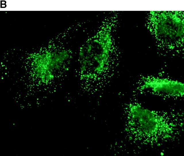 https://cdn.ncbi.nlm.nih.gov/pmc/blobs/d843/2169495/0bd17abc2b4b/JCB9906061.f8b.jpg