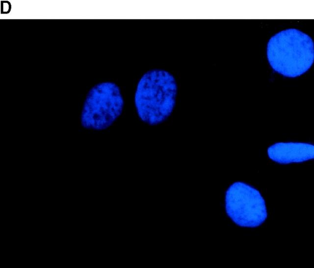 https://cdn.ncbi.nlm.nih.gov/pmc/blobs/d843/2169495/8f8888a1fee6/JCB9906061.f8d.jpg