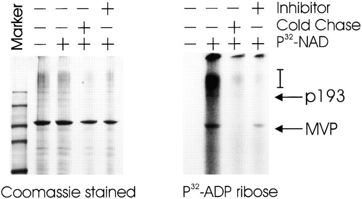 https://cdn.ncbi.nlm.nih.gov/pmc/blobs/d843/2169495/969fc550844a/JCB9906061.f5.jpg