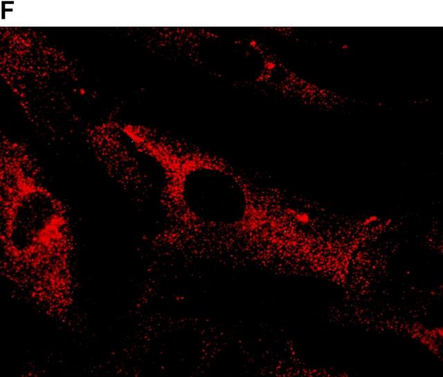 https://cdn.ncbi.nlm.nih.gov/pmc/blobs/d843/2169495/b827894f80d4/JCB9906061.f10f.jpg