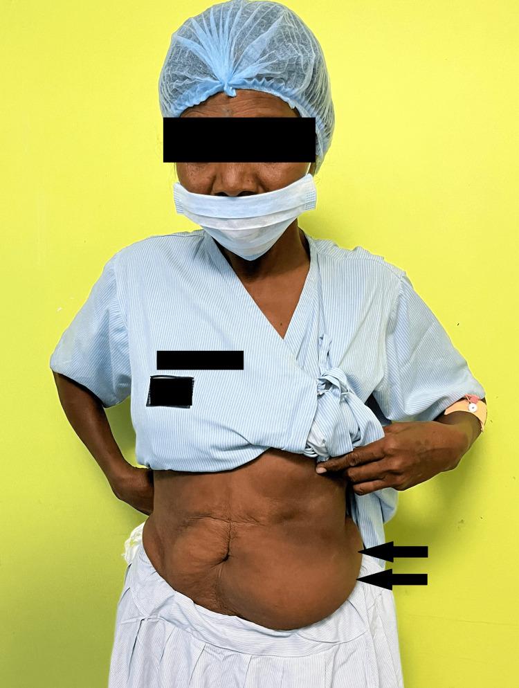 https://cdn.ncbi.nlm.nih.gov/pmc/blobs/d84a/11161671/4c7fe6094ee2/cureus-0016-00000059930-i01.jpg