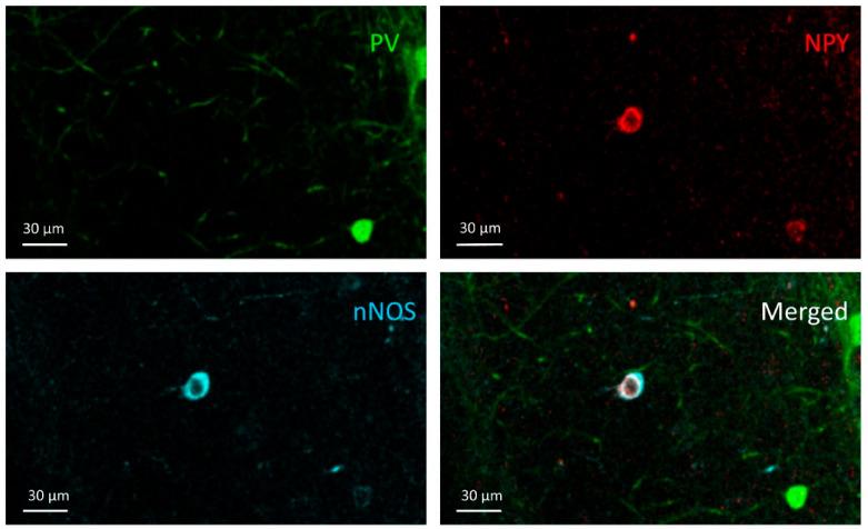 https://cdn.ncbi.nlm.nih.gov/pmc/blobs/d84d/7998440/11e4315f642f/cells-10-00520-g008.jpg