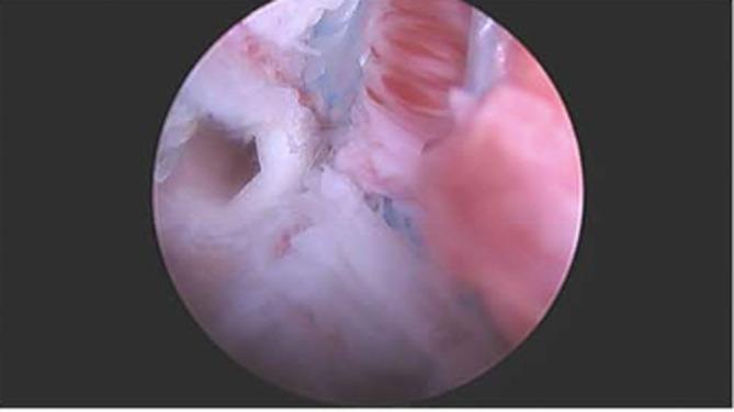 https://cdn.ncbi.nlm.nih.gov/pmc/blobs/d84e/10160428/4f1f09c6679c/CCR3-11-e7210-g003.jpg
