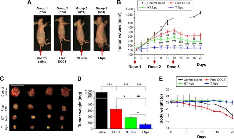 https://cdn.ncbi.nlm.nih.gov/pmc/blobs/d84f/5628680/cc6dd4b6e34f/ijn-12-7165Fig8.jpg