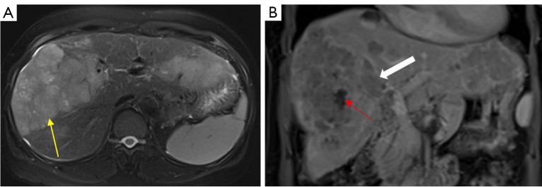 https://cdn.ncbi.nlm.nih.gov/pmc/blobs/d851/11651849/14c4fcfb33c9/tcr-13-11-5929-f4.jpg