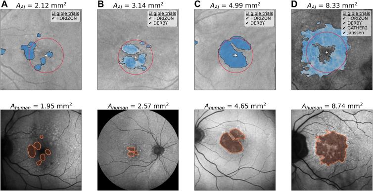 https://cdn.ncbi.nlm.nih.gov/pmc/blobs/d852/11321286/79cfdbf3e353/gr3.jpg