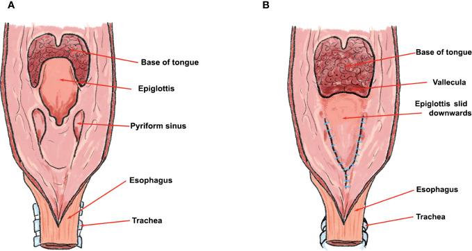 https://cdn.ncbi.nlm.nih.gov/pmc/blobs/d85b/10801030/0f47b877146d/fonc-13-1284266-g002.jpg