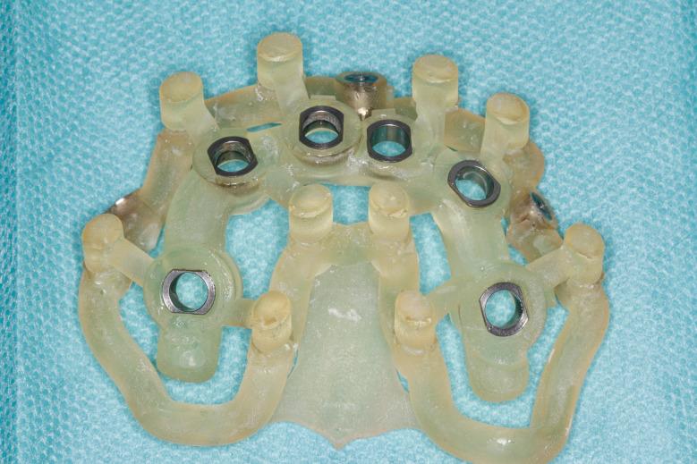 https://cdn.ncbi.nlm.nih.gov/pmc/blobs/d861/11143148/56591621ef0f/40729_2024_547_Fig5_HTML.jpg