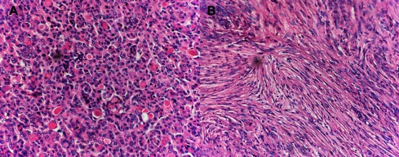 https://cdn.ncbi.nlm.nih.gov/pmc/blobs/d862/6510395/cd146631cb30/CMAR-11-4085-g0002.jpg