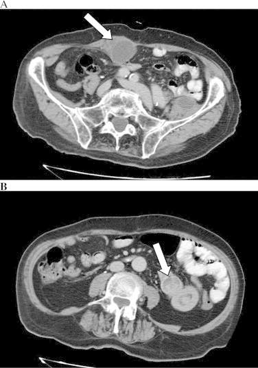 https://cdn.ncbi.nlm.nih.gov/pmc/blobs/d86a/4275831/0dc8cae83239/gr1.jpg