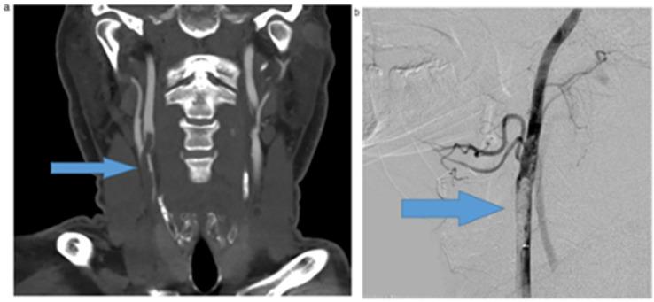 https://cdn.ncbi.nlm.nih.gov/pmc/blobs/d873/9409845/8689ec6be5ef/jcdd-09-00268-g011.jpg
