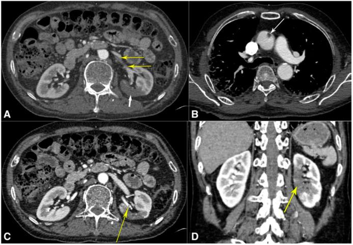 https://cdn.ncbi.nlm.nih.gov/pmc/blobs/d873/9409845/d04cf115d886/jcdd-09-00268-g008.jpg