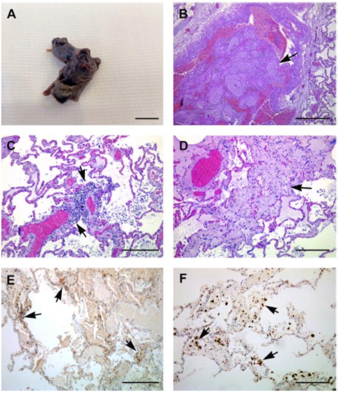 https://cdn.ncbi.nlm.nih.gov/pmc/blobs/d873/9409845/d2af6ffa38d2/jcdd-09-00268-g005.jpg