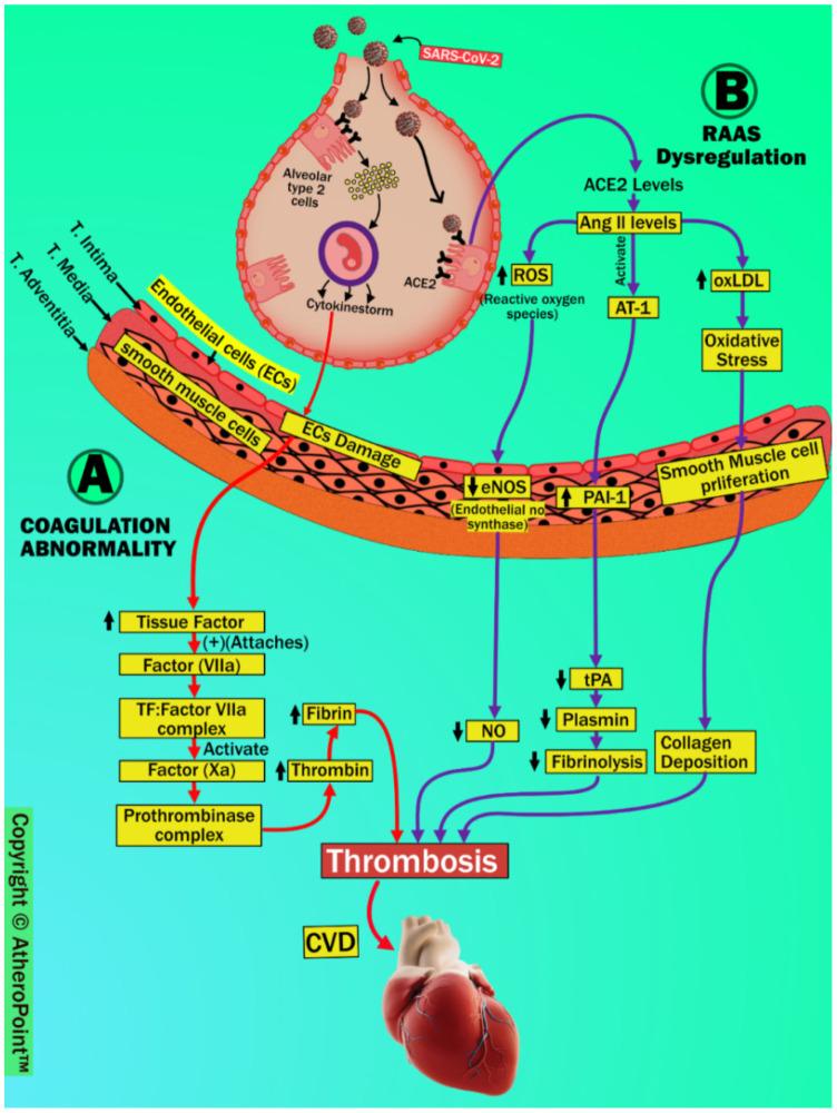 https://cdn.ncbi.nlm.nih.gov/pmc/blobs/d873/9409845/ea6e4e272893/jcdd-09-00268-g009.jpg