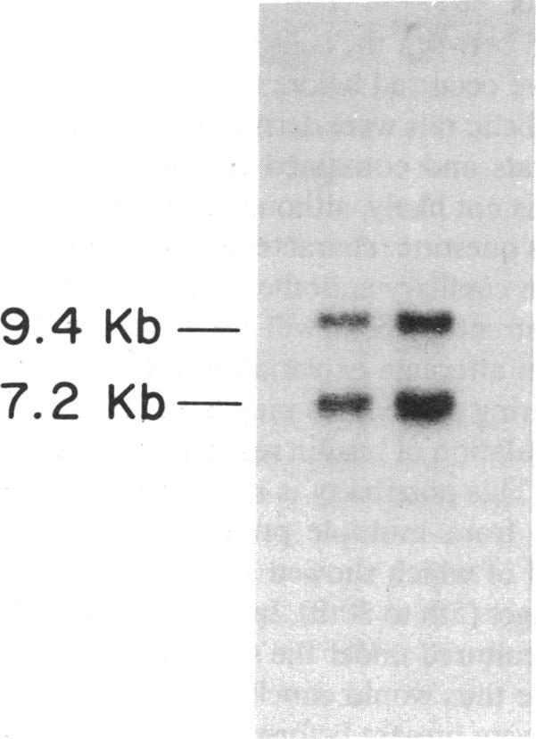 https://cdn.ncbi.nlm.nih.gov/pmc/blobs/d87b/303652/90c218f3e006/jcinvest00082-0145-a.jpg