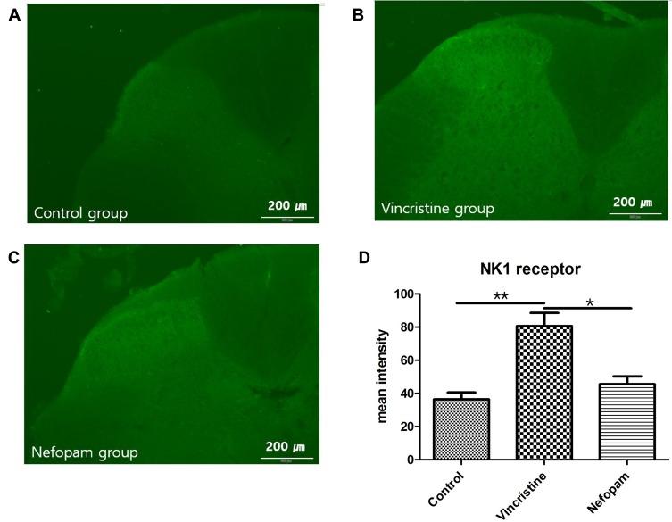https://cdn.ncbi.nlm.nih.gov/pmc/blobs/d87b/7012248/dc5b223fd255/JPR-13-323-g0003.jpg