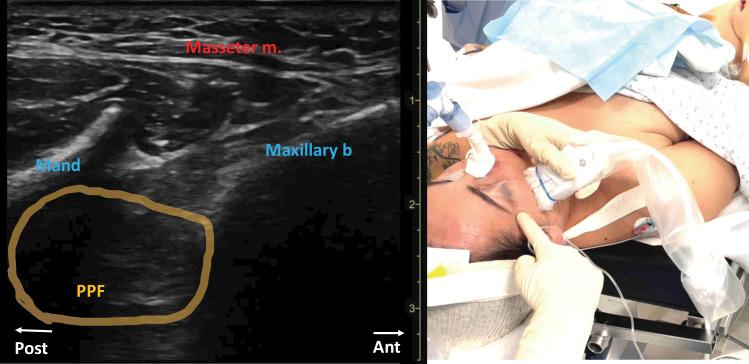 https://cdn.ncbi.nlm.nih.gov/pmc/blobs/d87f/12322447/c199a4ad1f7f/rapm-50-7-g001.jpg
