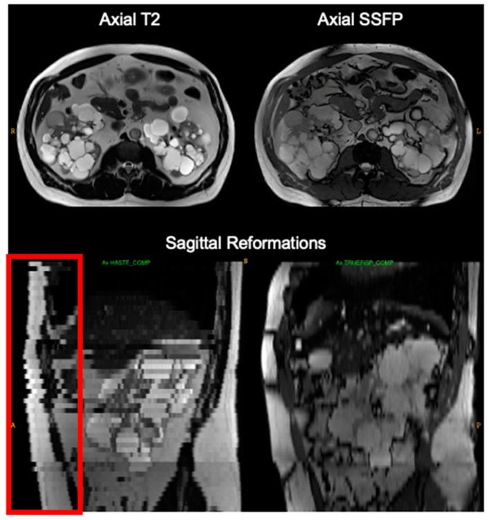 https://cdn.ncbi.nlm.nih.gov/pmc/blobs/d882/10366880/46fc171c4048/tomography-09-00107-g003.jpg