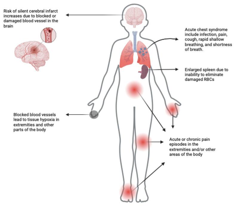 https://cdn.ncbi.nlm.nih.gov/pmc/blobs/d885/11120250/9b76d37f4386/cells-13-00848-g001.jpg